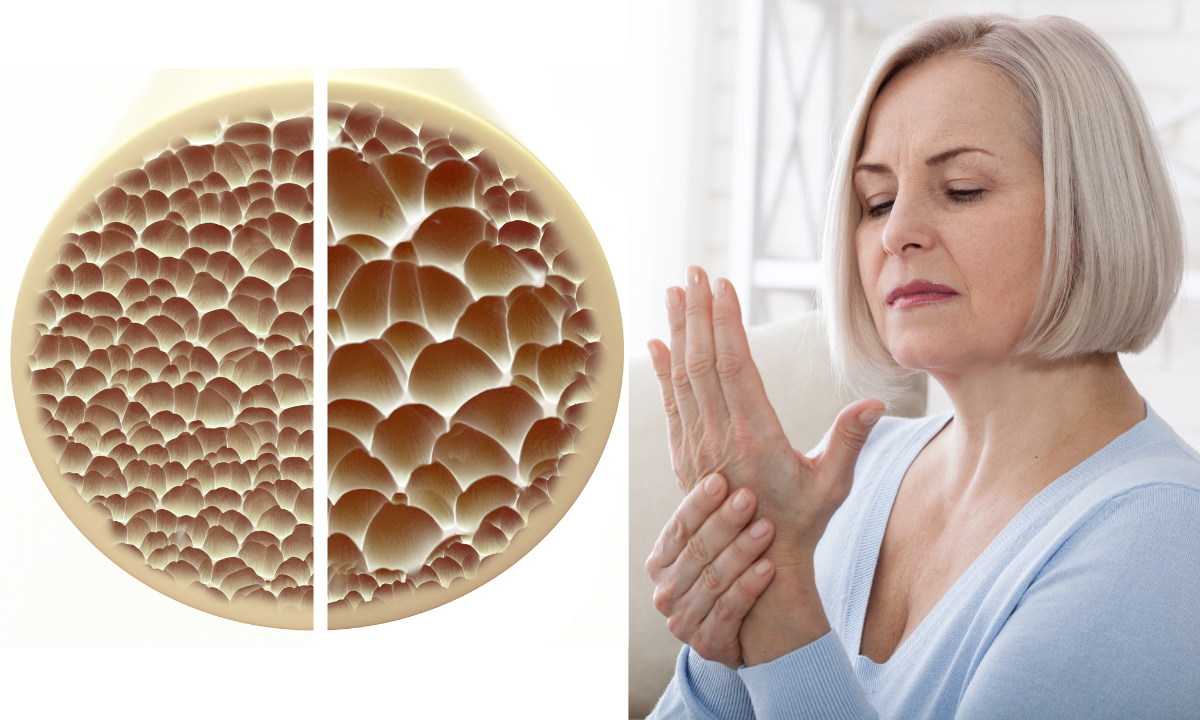 Osteoporosis: Risks, symptoms and prevention of bone fractures
