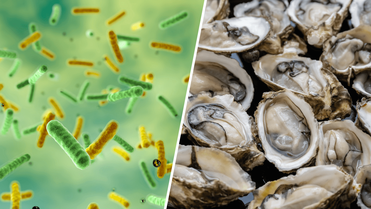 Flesh-eating bacteria kill at least three people in the US
