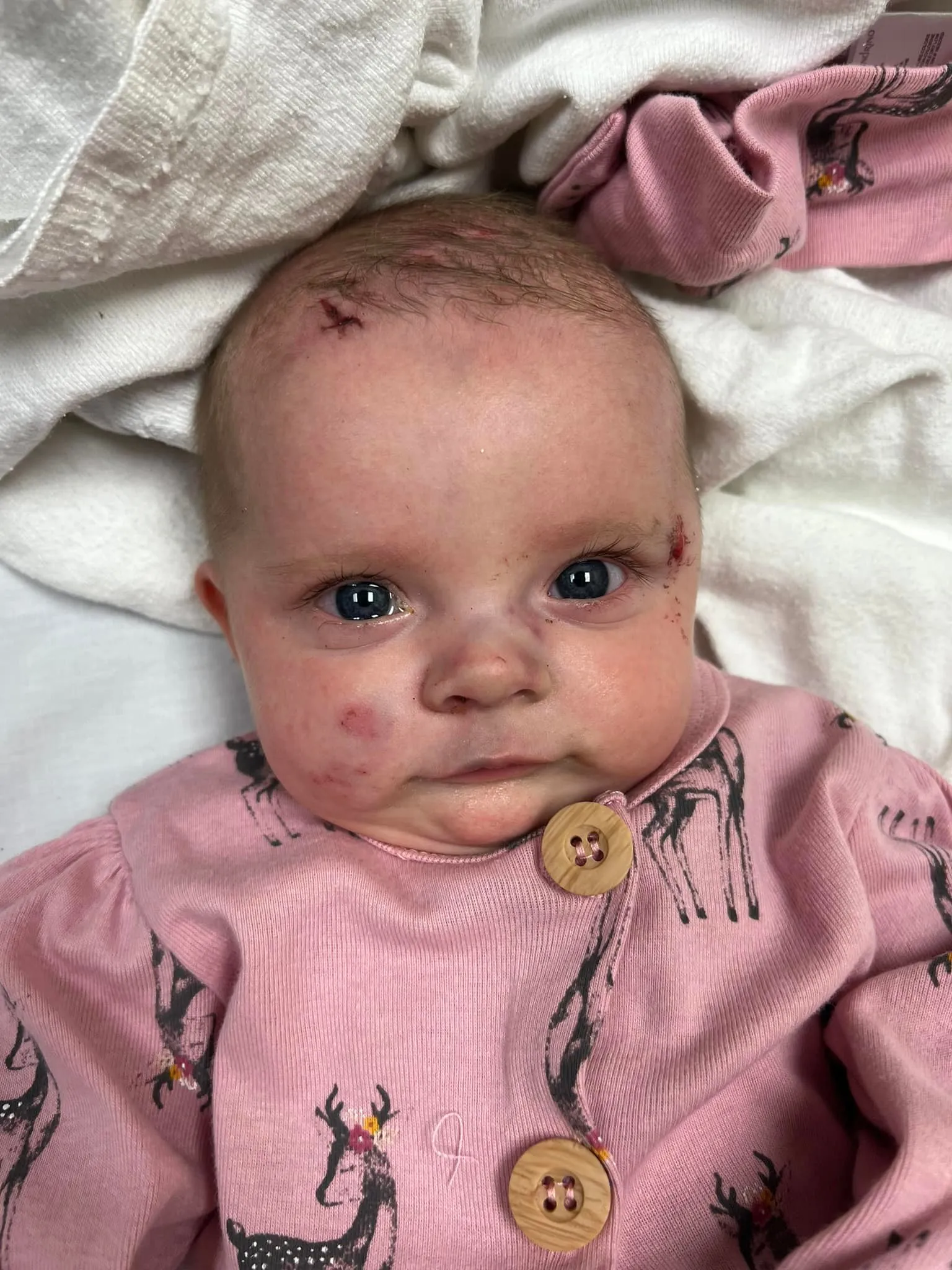 This 4-month-old was discovered alive on a fallen tree after being carried away by a deadly tornado