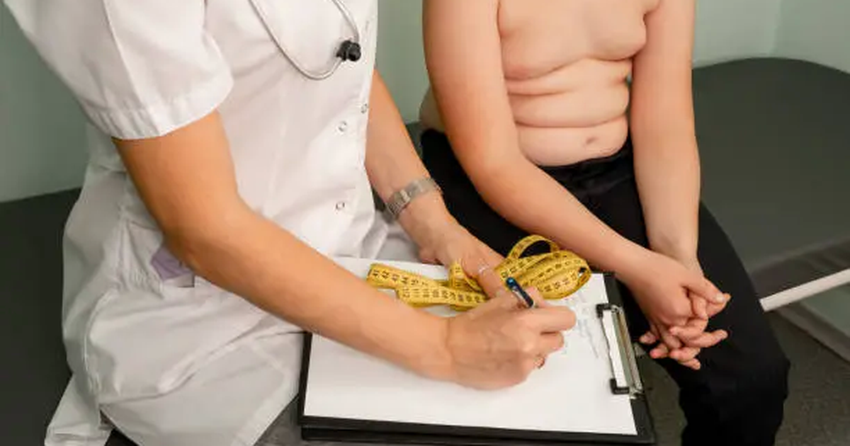 Severe childhood obesity is increasing and affects thousands in the US
