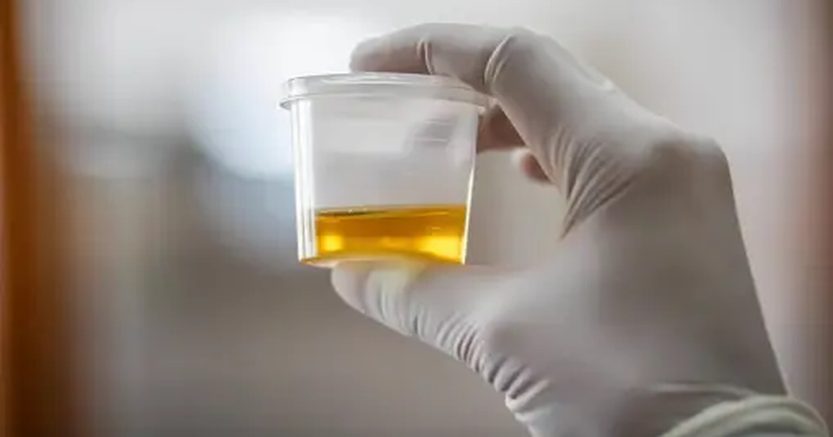 Scientists reveal the reason for the yellow color in urine
