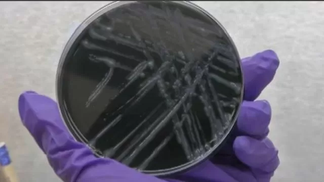 They investigate a possible outbreak of Legionnaires' disease
