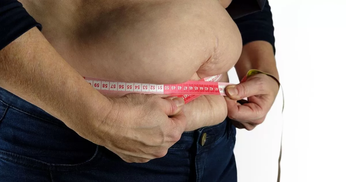 Obesity affects more than 1 billion people in the world

