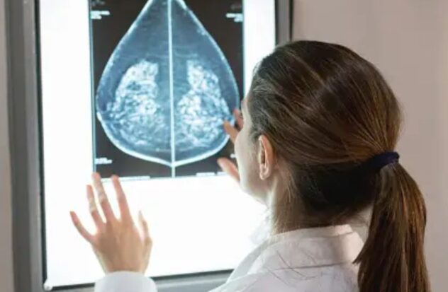 The US recommends mammograms starting at age 40

