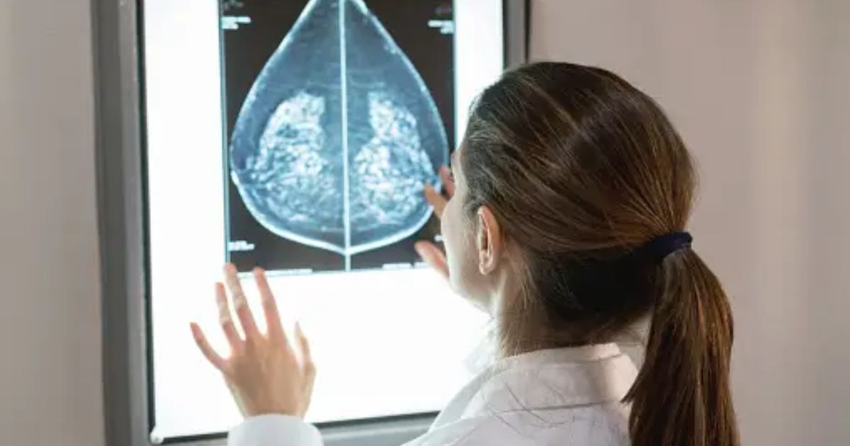 The US recommends mammograms starting at age 40
