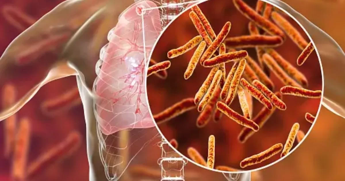Tuberculosis cases register the largest increase in the last decade
