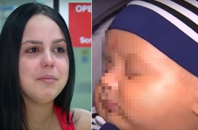 Cuban mother's baby saved life with intrauterine surgery performed for the first time in Florida
